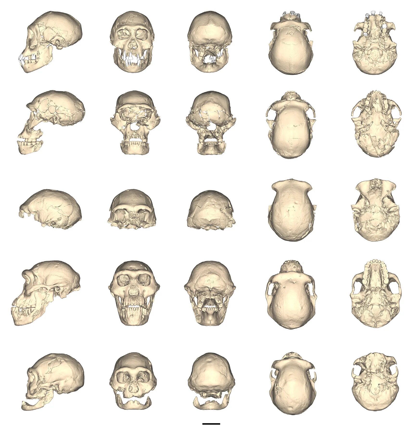 Варианты формы черепа. Формы черепа человека.