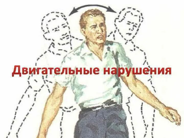 Нарушение координации мышц