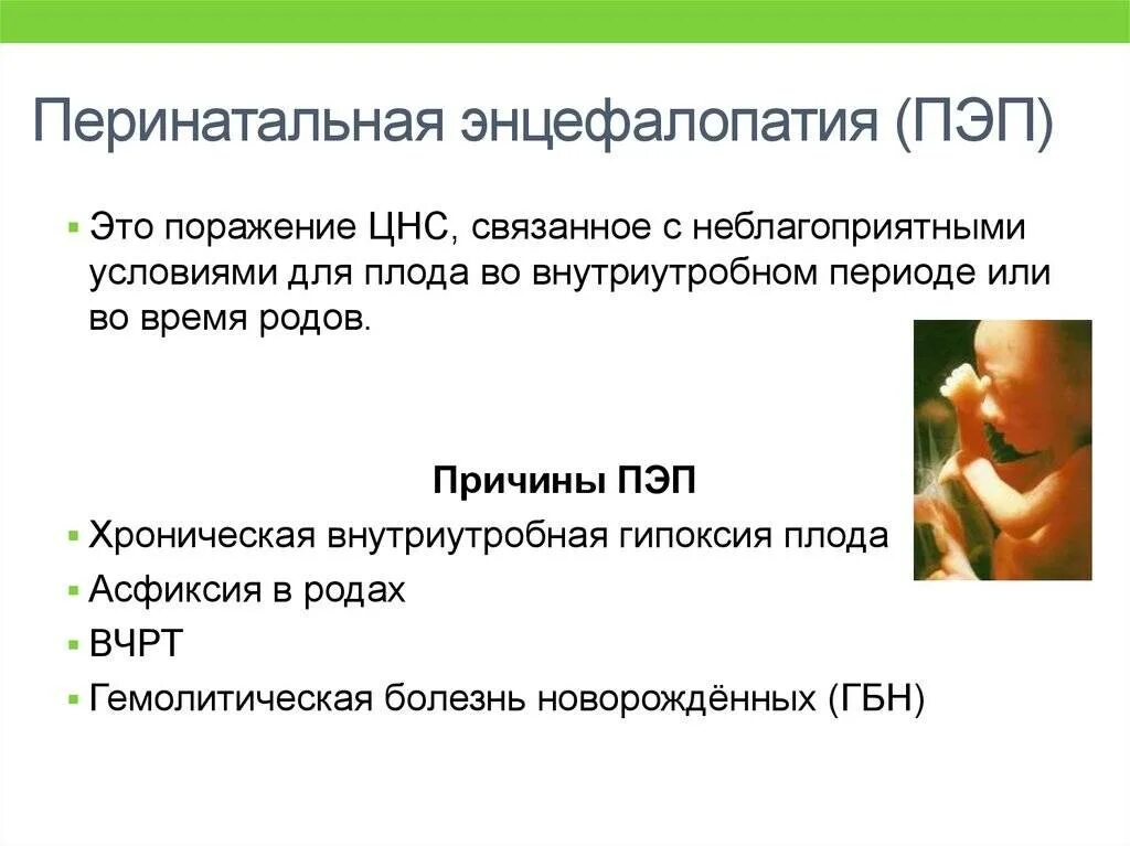 Перинатальная энцефалопатия у детей. Перинатальная энцефалопатия у детей. Осложнения перинатальной энцефалопатии. Пеленальная энцефалопатия. Пеленальная энцефалопатия.