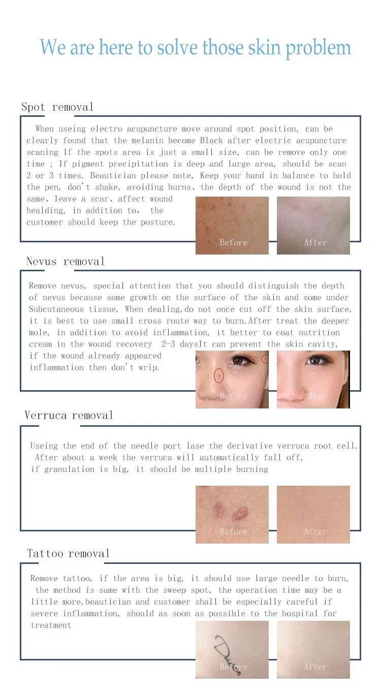 Инструкция point mole beauty pen на русском. Beauty Mole removal Pen как пользоваться. Mole removal Pen manual инструкция. Beauty Mole removal Pen инструкция. Beauty Mole removal Sweep spot Pen инструкция на русском
