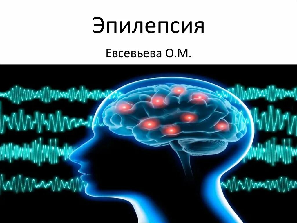 Эпилепсия презентация. Эпилепсия презентация по неврологии.