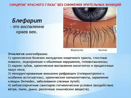 Для протирания ресниц и век можно использовать