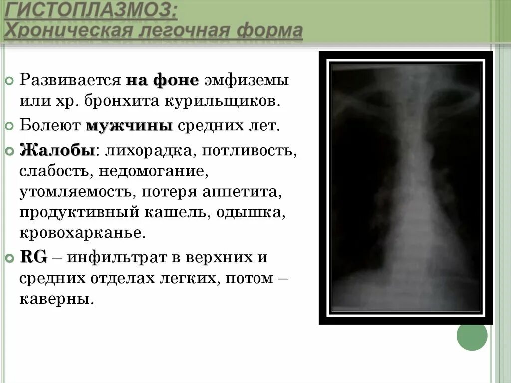 Эмфизема хронического бронхита. Обострение бронхита курильщика. Хрипы при бронхите курильщика. Хронический бронхит без кашля курильщика.