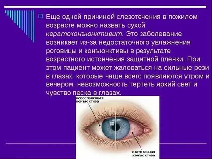 Почему на улице слезятся глаза у взрослого