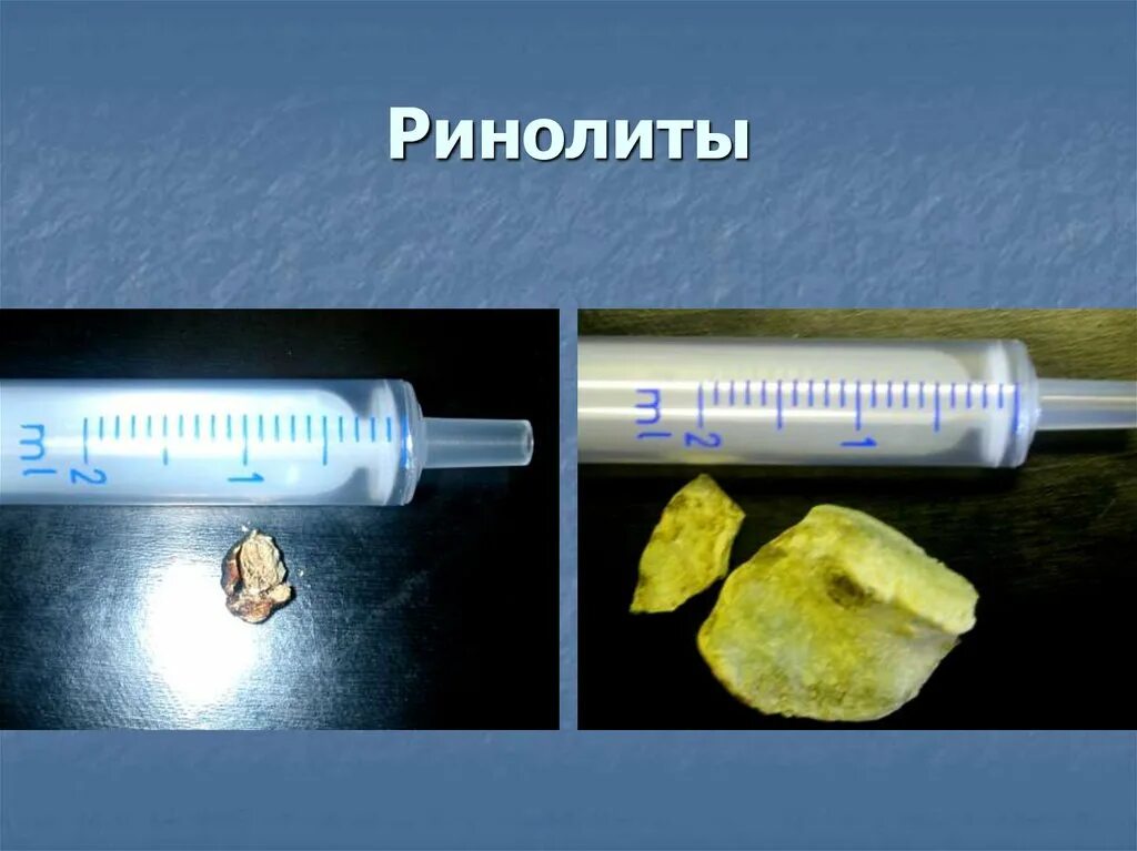 Полость золота