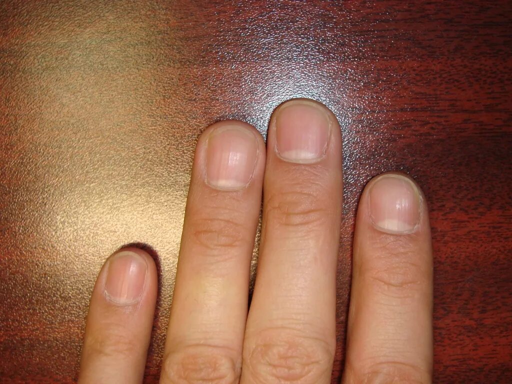 Как подстричь ноготь на пальце. Здоровые мужские ногти. Нормальные мужские ногти. Подстриженные мужские ногти. Мужские ногти на руках.