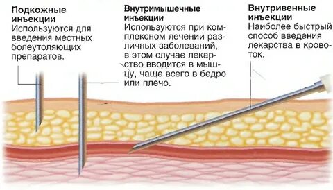 Как правильно набрать лекарство укол