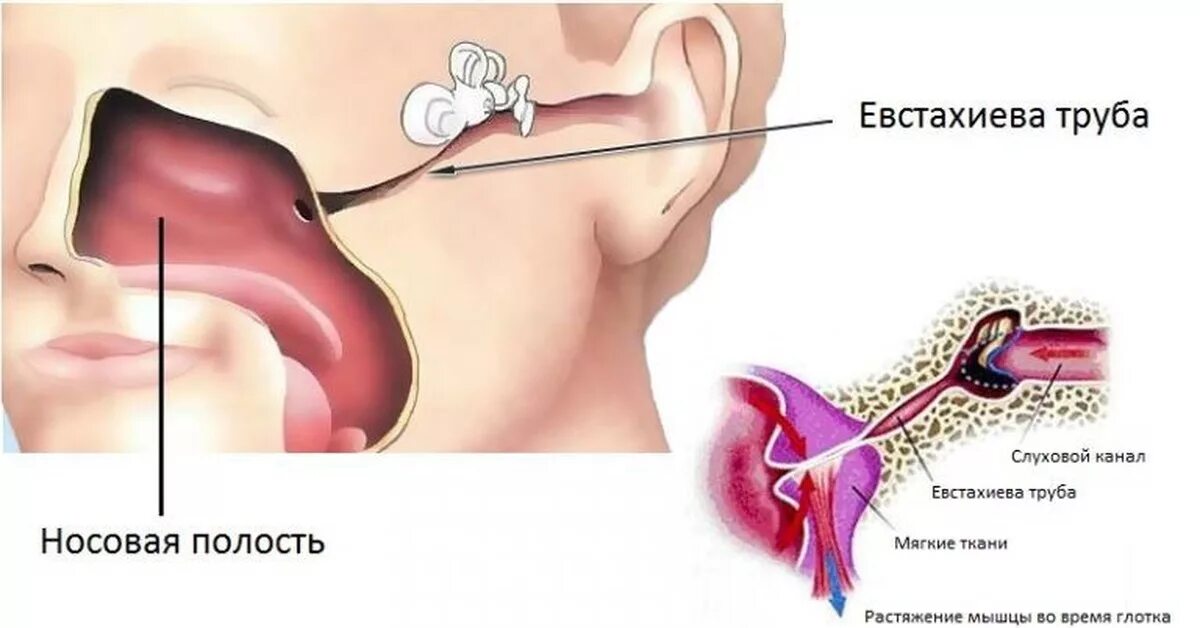 Почему щелкает ухо когда глотаешь. Евстахиева труба соединяет полость среднего уха с носоглоткой. Анатомия уха и евстахиевой трубы. Евстахиева труба и носоглотка.