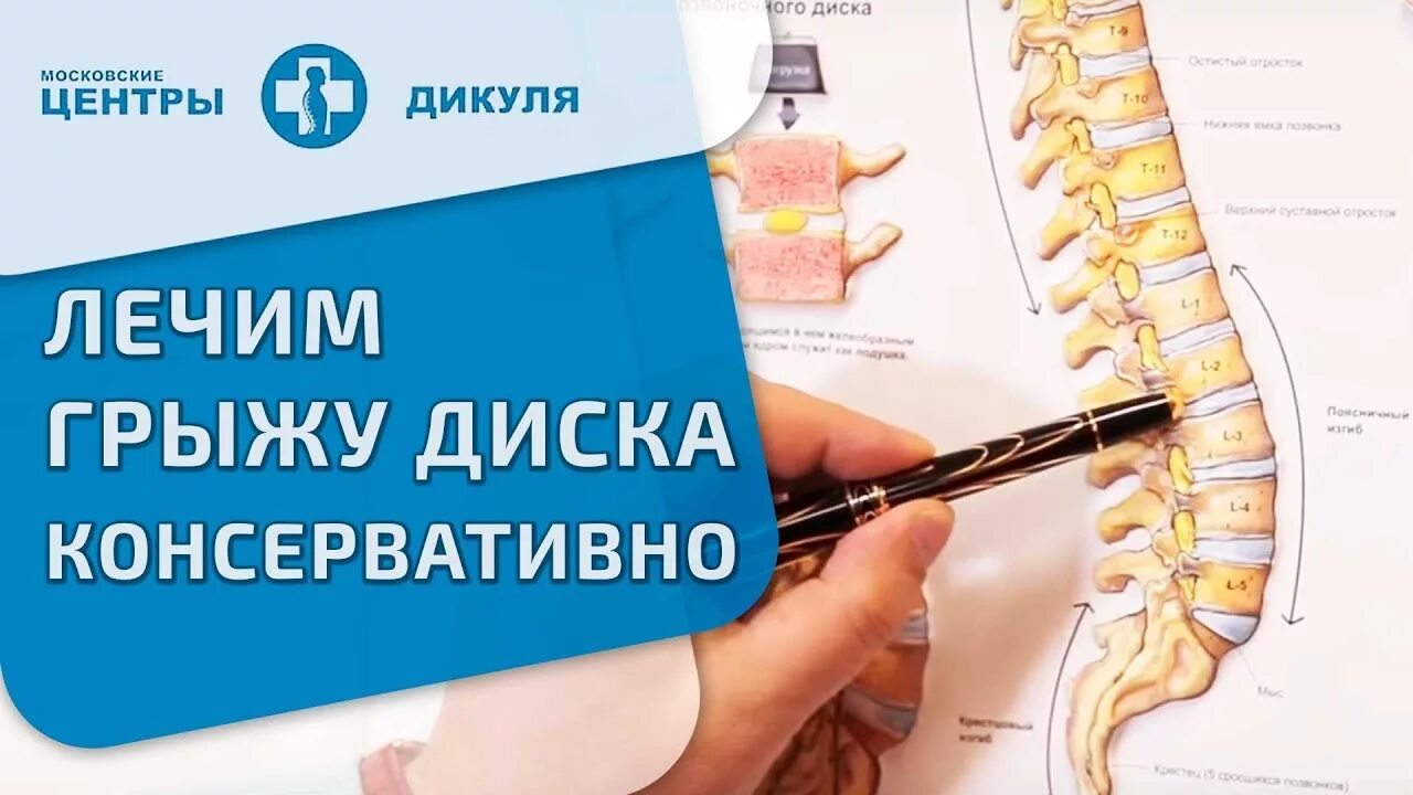 Грыжа диска. Диск Дикуля. Плакаты грыжи позвоночника. Консервативное лечение грыжи