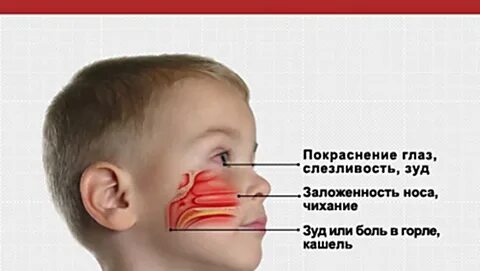 Не дышит нос у ребенка 1 год