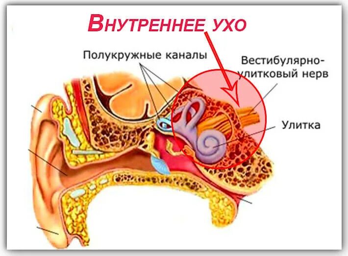 Боли внутреннего уха. Воспаление среднего уха (лабиринтит);. Воспаление внутреннего уха (лабиринтит) возникает. Внутренний отит (лабиринтит). Воспалительные заболевания внутреннего уха (лабиринтиты)..