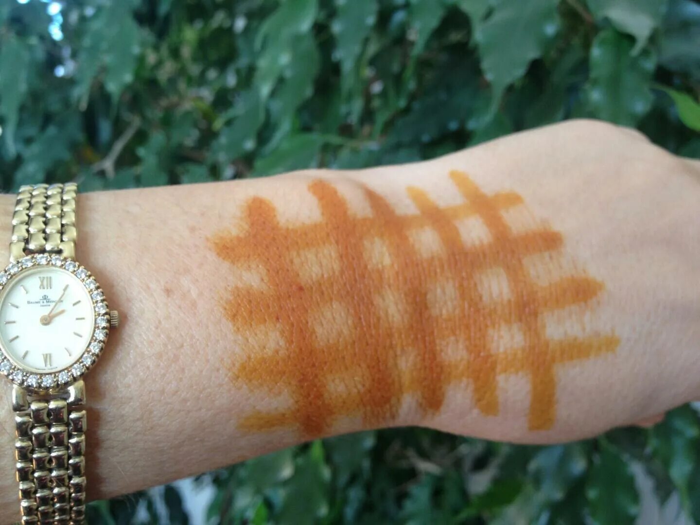 Едовая сетка. Йодовая сеточка на руке. Сеточка из йода на спине. Едовая сетка. Едовая сетка.