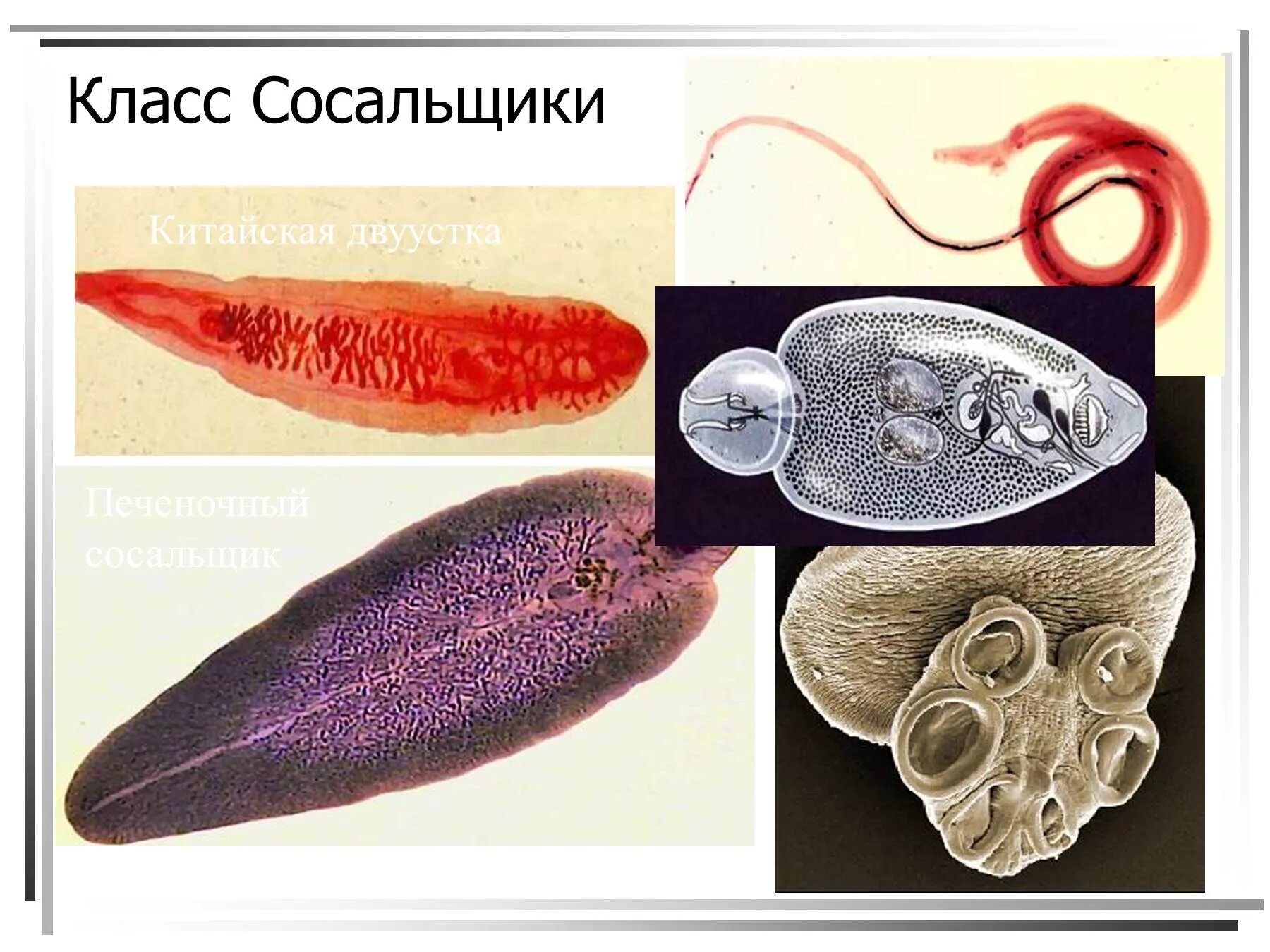 Плоские черви паразиты сосальщики. Плоские черви (сосальщики и ленточные черви). Плоские черви (класс трематод);. Червяки паразиты сосальщики.