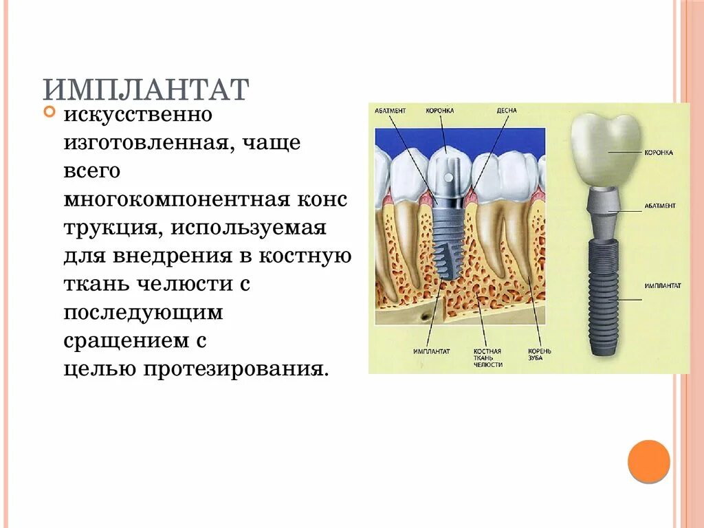 Как определить имплантацию