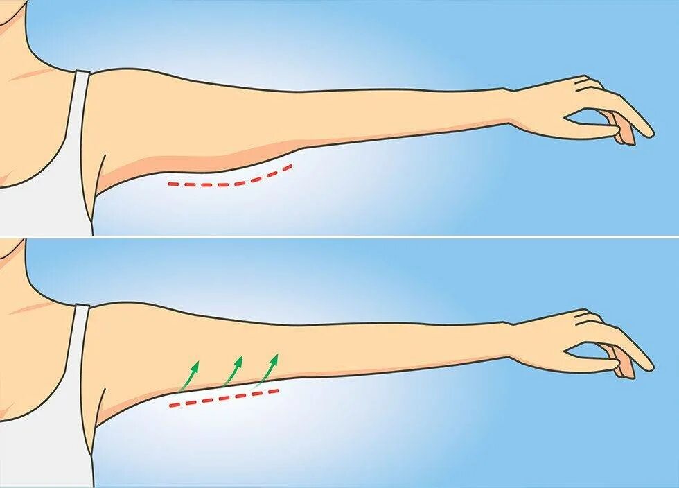 Упражнения для обвисших рук. Упражнения для обвисшей кожи на руках. Подтянуть мышцы рук. Можно подтянуть руки