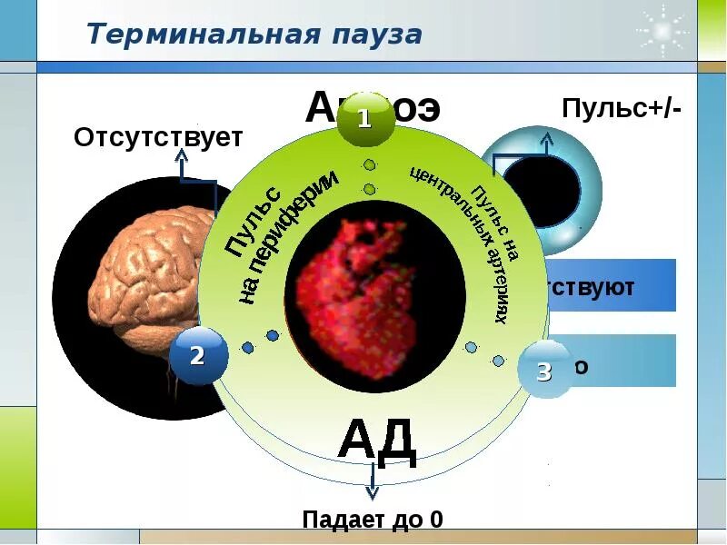Терминальная пауза продолжается. Терминальная пауза. терминальные состояния. терминальное состояние человека это.