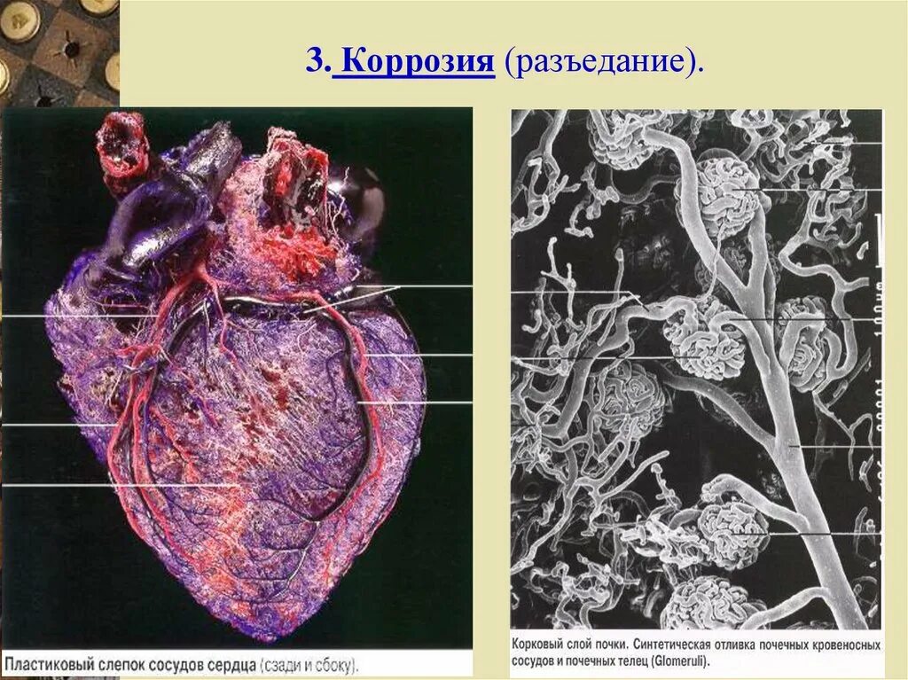 Разъедание стенок сосудов 7 букв сканворд. Причины повышенной кровоточивости. Разъедание. Повреждение эндотелия сосудов. Разъедание стенок сосудов 7 букв сканворд.