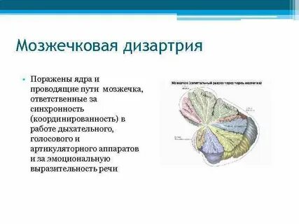 Дизартрия структура
