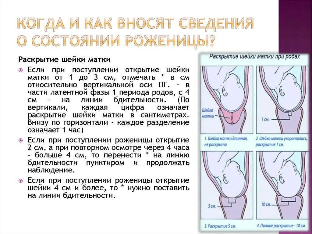 Раскрытие 1 палец через. Этапы раскрытия шейки матки перед родами. Роды раскрытие шейки матки на 2 пальца. Раскрытие шейки матки при 3 родах. Открытие шейки.