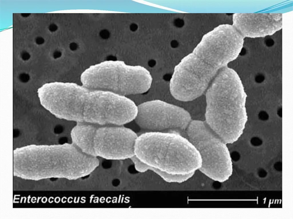 Кишечная палочка энтерококк. Энтерококк фекальный микроскопия. Энтерококус фекалис. Энтерококки бактерии. Enterococcus faecalis (энтерококк фекальный).