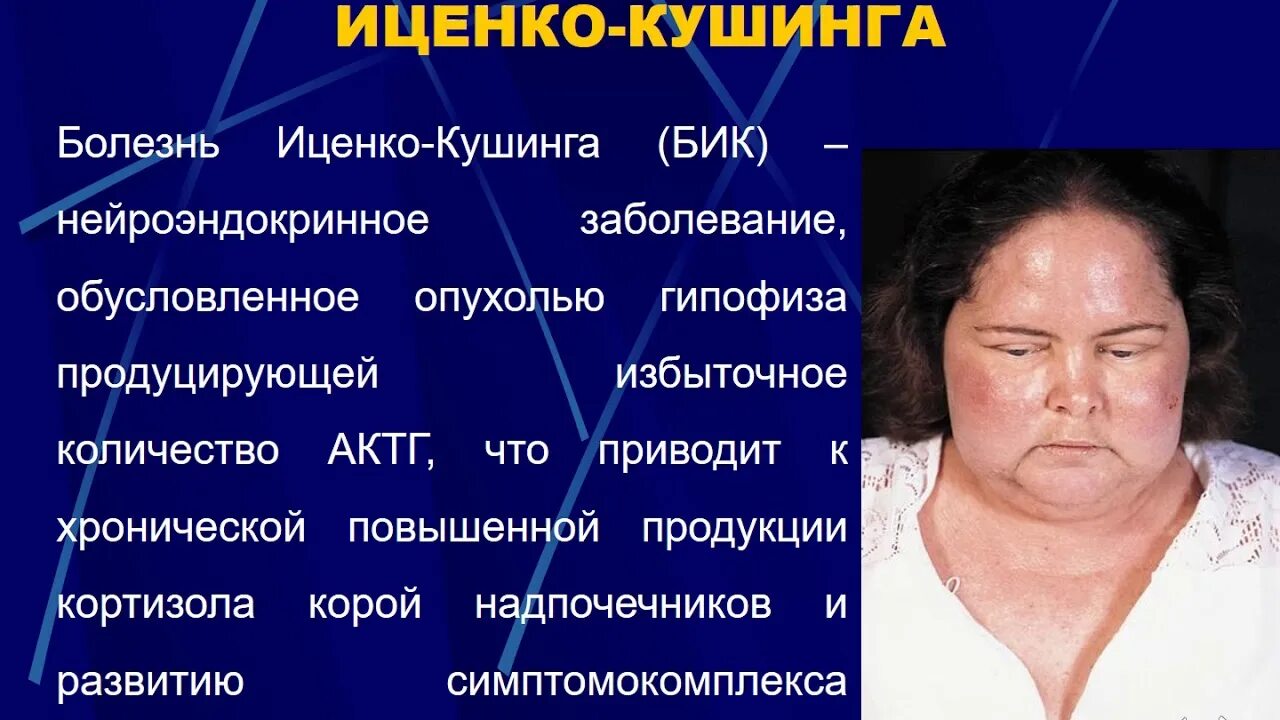 Симптомы повышенного кортизола у мужчин. Синдром Иценко Кушинга побочные эффекты. Синдромы Рейфенштейна, Иценко-Кушинга.. Синдром Аддисона Иценко-Кушинга. АКТГ-зависимый синдром Кушинга.