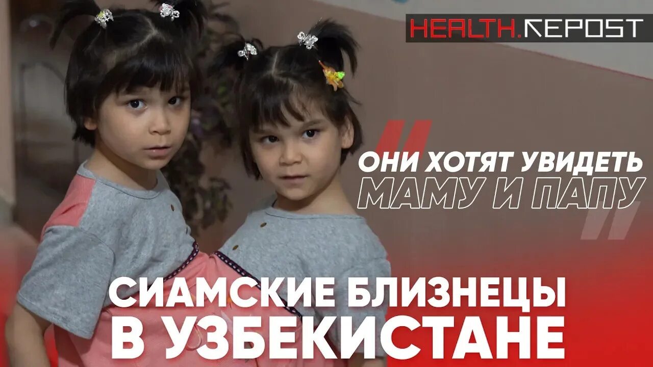 Жила была близнецы. Близнецы в узбекистане имена. сёстры кривошляповы сиамские близнецы.