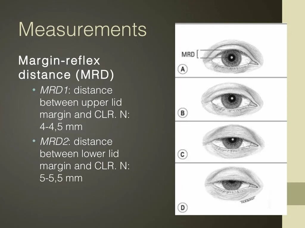 Ptosis латынь