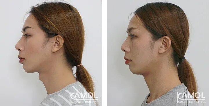 Почему у девушки есть кадык. Меган фокс (megan fox). Меган фокс шея кадык. Знаменитые девушки с кадыком. Илона новоселова кадык.