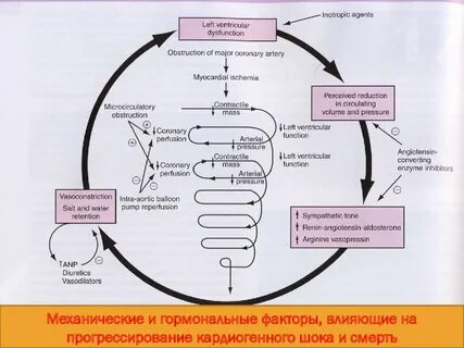 Кардиогенный шок патогенез