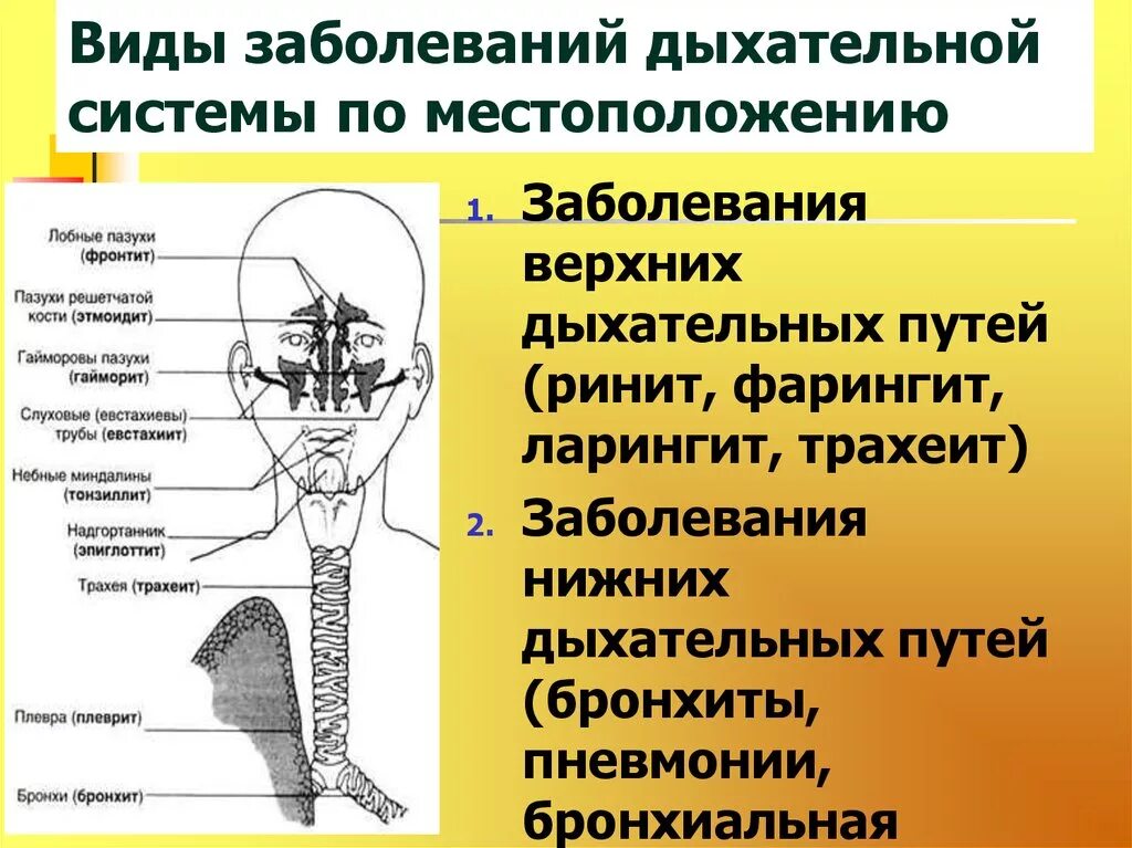 Патологии дыхательных путей. Болезни дыхательной системы. Виды заболеваний. Заболевания нижних дыхательных путей. Виды заболеваний органов дыхания.