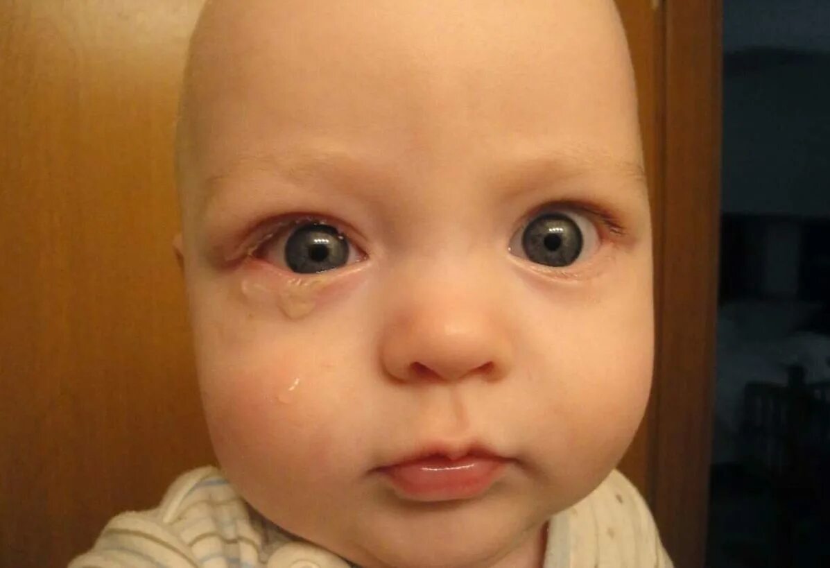 у трехмесячного ребенка глаза