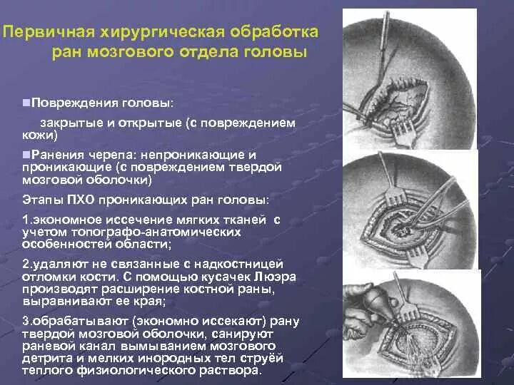 Технологическая схема обработки субпродуктов птицы. Первичная обработка мозгов. Технологическая схема шерстных субпродуктов. Первичная хирургическая обработка непроникающих ран свода черепа. Первичная обработка субпродуктов.