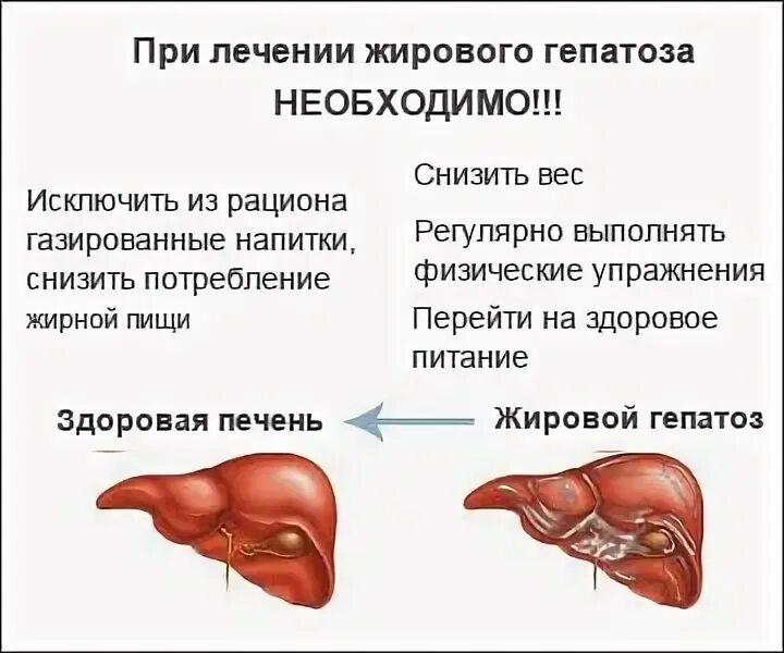 Как питаться при гепатозе печени. Как питаться при гепатозе печени