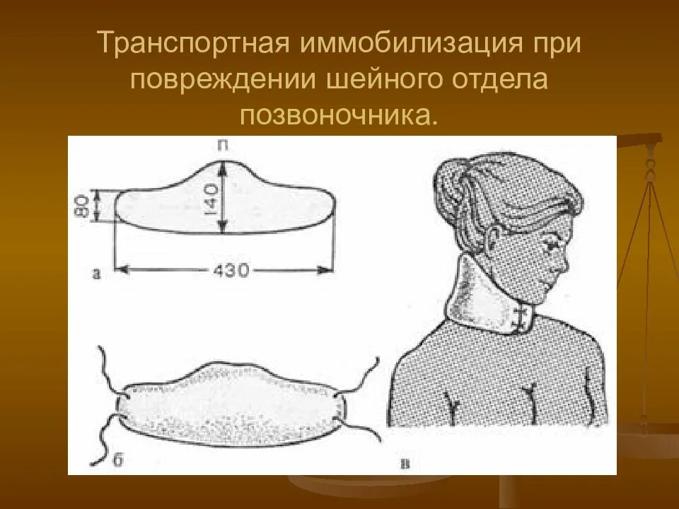 Иммобилизация при повреждении шейного отдела позвоночника. Шина для шейного отдела позвоночника. Транспортная иммобилизация при переломе позвоночника. Транспортная иммобилизация головы шиной еланского. При подозрении на травму шейного отдела позвоночника:.