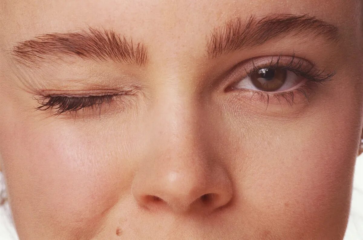 Человек протирает глаза. Отек верхнего и нижнего века. Поднять веки. Подергивание глаза причины. Нависшее веко.