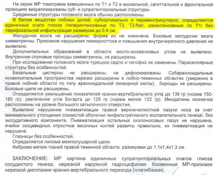 Глиоз в веществе головного мозга что такое. Очаговые изменения вещества головного мозга дисциркуляторного. Глиоз в белом веществе головного мозга. Мелкие очаговые изменения вещества мозга. Очаги глиоза сосудистого генеза.