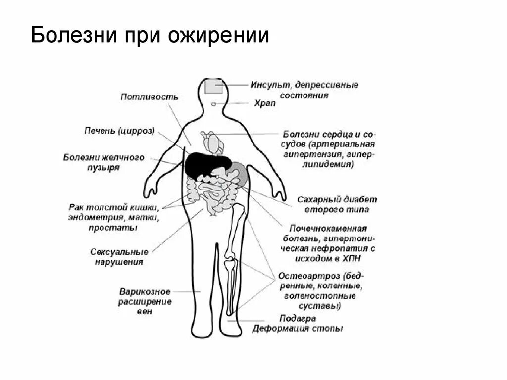 Заболевание низкий вес. Заболевания при ожирении. Ожирение сопутствующие заболевания. Заболевания связанные с лишним весом. Болезни связанные с избыточным весом.