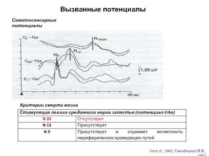 Вызванный исследования