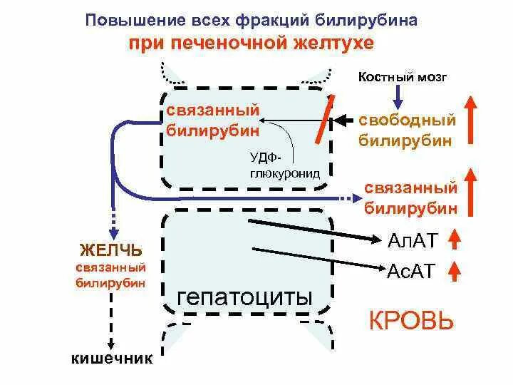 Лечение повышенного билирубина в крови. Повышение непрямой фракции билирубина. Непрямой билирубин при желтухе. Прямая и непрямая фракция билирубина. Повышение прямой фракции билирубина.