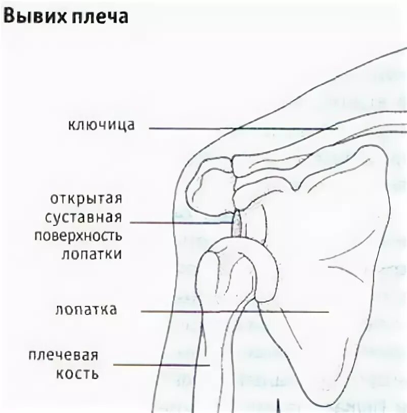 Болит плечо левой руки ноющая. Плечевой сустав левой руки. Болит плечевой сустав левой. Болит плечевой сустав левой руки.