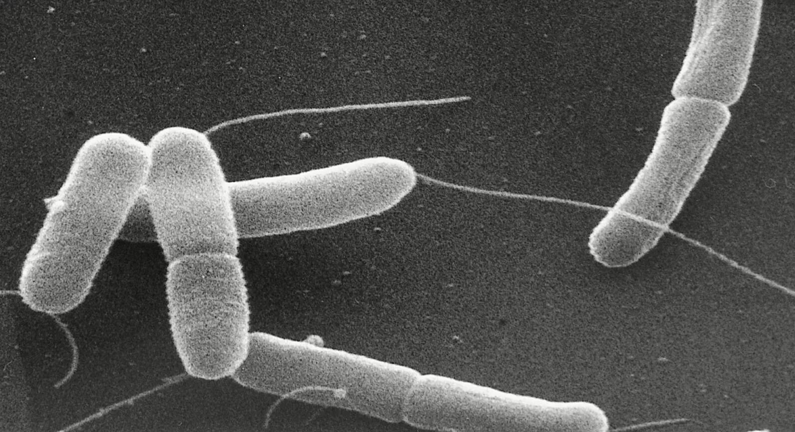 Микроорганизмы кишечная палочка. Кишечная палочка Escherichia coli. Бактерия Escherichia coli. Бактерия эшерихия коли. Кишечная палочка электронный микроскоп.