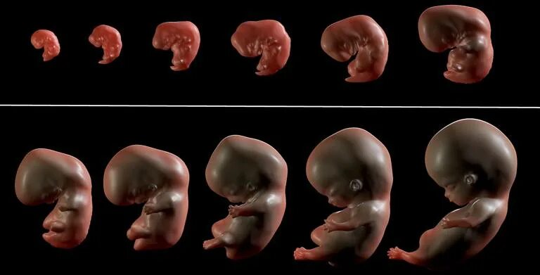 Как выглядит плод человека MPs to vote on lowering abortion time limit