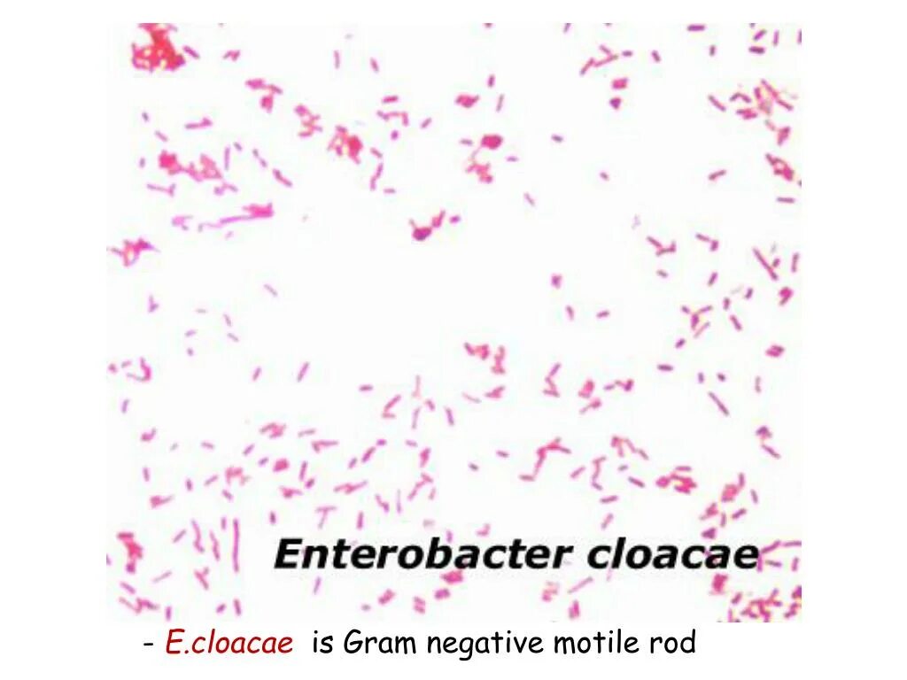 Enterobacter cloacae под микроскопом. Энтеробактер микроскопия. Cloacae энтеробактерии. Энтеробактер клоаке. Enterobacter cloacae что это