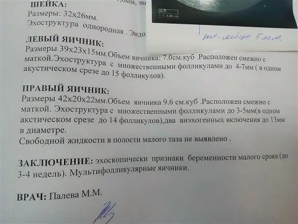 Шейка в 25 недель. Объем яичников. Объем яичника. Расшифровка УЗИ яичников у женщин. Подсчет объема яичников по УЗИ.