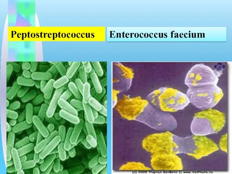 Peptostreptococcus. Пептострептококки микробиология. Enterococcus faecium под микроскопом. Энтерококк фэциум. Морфология пептострептококков.