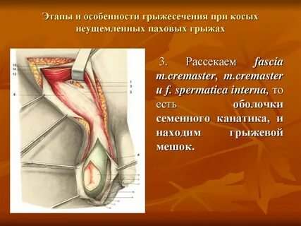 Операция грыжа паховая сколько