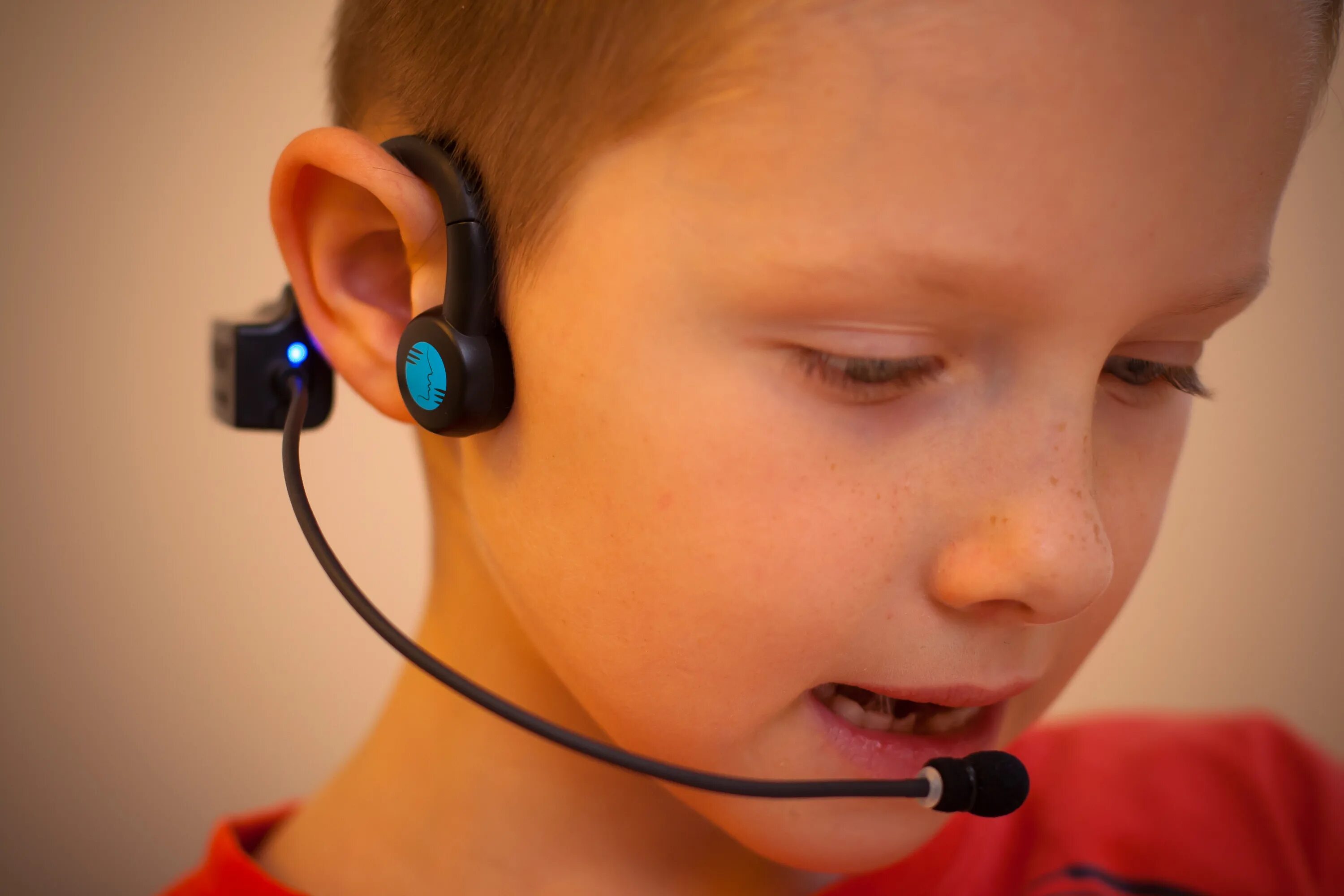 Аппарат cochlear кохлеарный. Форбрейн. Cochlear склонение. Слуховая стимуляция. Фониатр альфред томатис.