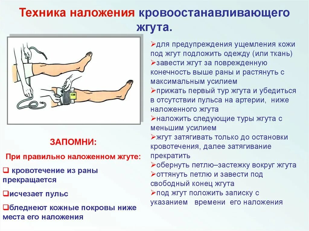 Кровоостанавливающий жгут время максимальное. При правильном наложении кровоостанавливающего жгута на конечность:. техника наложения кровоостанавливающего жгута. методика наложения кровоостанавливающего жгута. техника наложения кровоостанавливающего жгута на бедро.