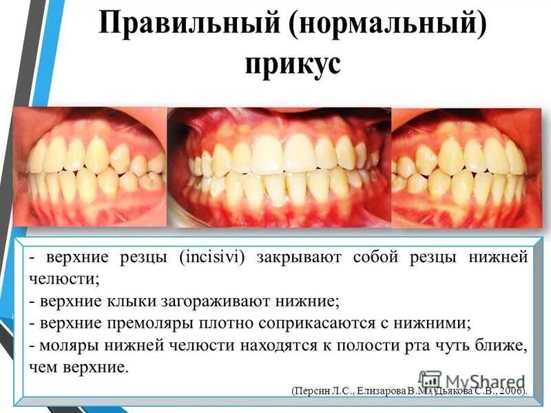 Выравнивание зубов, исправление прикуса в Минске - цены на услуги в УСК