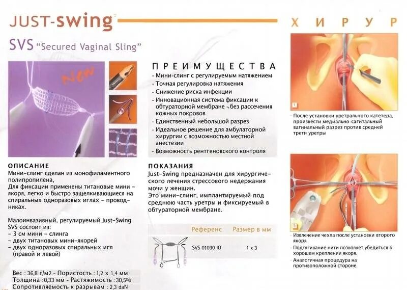 Непроизвольное Мочеиспускание У Женщин Во Время Секса
